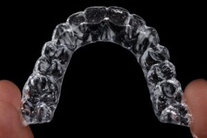 Invisalign Braces for Adults